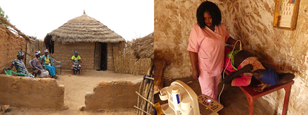 à gauche les femmes attendent devant la case de santé. A droite, la sage femme réalise une échographie.